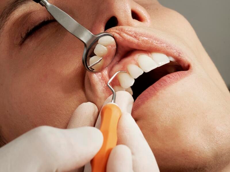 Tractament dental professional